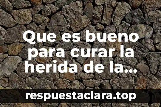 Que es anticipo de impuestos en contabilidad 8 Que es bueno para curar la herida de la cesarea