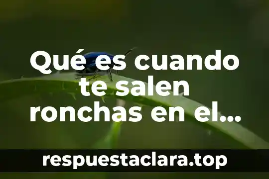 Qué es cuando te salen ronchas en el cuerpo